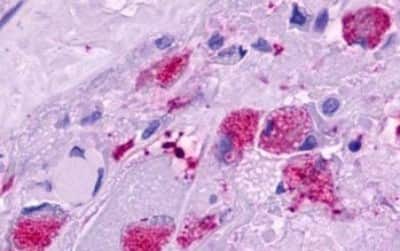 Immunohistochemistry: Motilin R/GPR38 Antibody [NBP3-14408]